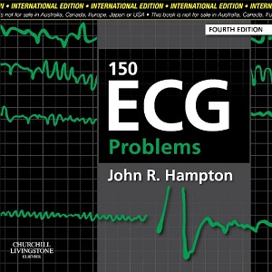 Фото - 150 ECG Problems, International Edition, 4th Edition